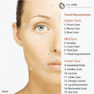 Injection-Chart-